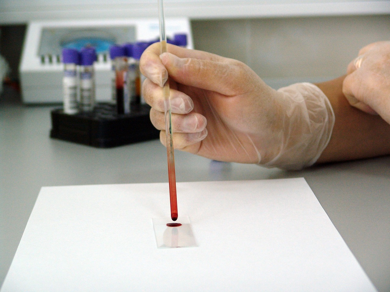 科学家利用HIV背叛艾滋病毒
